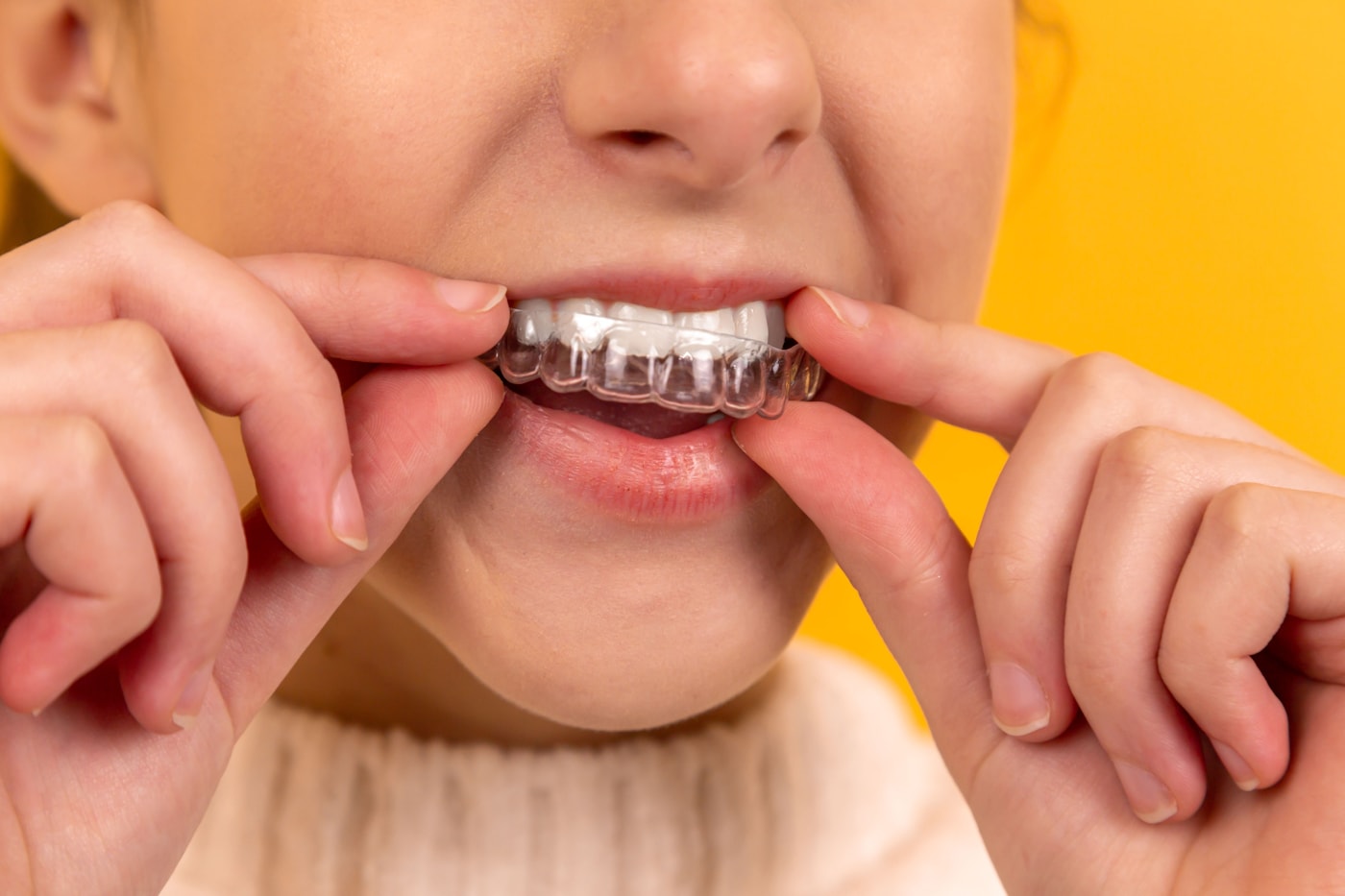 Servicio de Resinas dentales